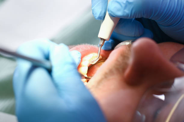 Best Emergency Pediatric Dentist  in Mcswain, CA